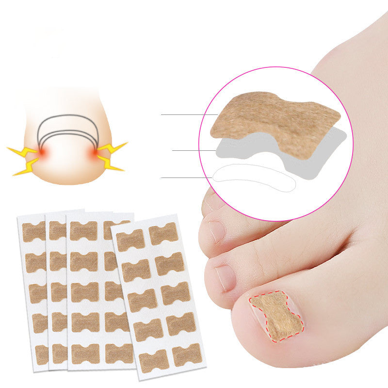 Glue-free orthopaedic nail fixation device