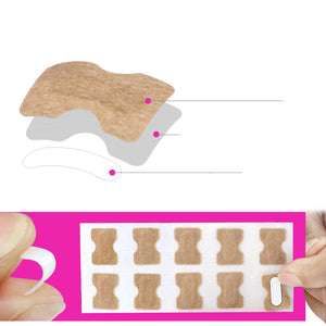 Glue-free orthopaedic nail fixation device