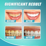 【LAST DAY PROMOTION】 - INTENSIVE STAIN REMOVAL WHITENING TOOTHPASTE